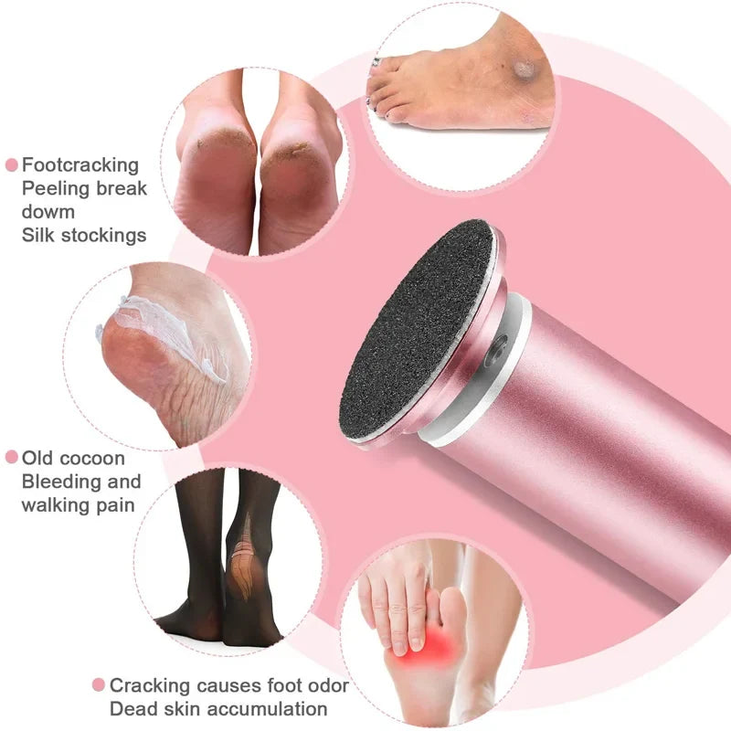 Electric Foot Callus Remover – Rechargeable Pedicure File Tool
