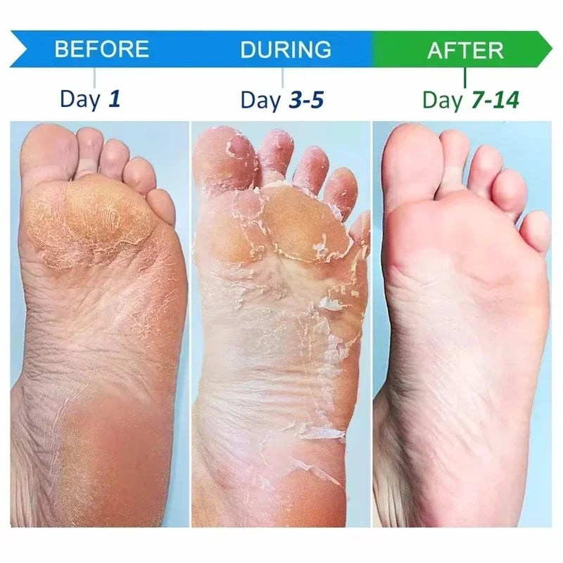 LAIKOU Herbal Foot Cream Spray – Soften & Moisturize Heels