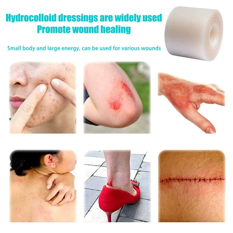 Hydrocolloid Roll Bandage – Waterproof Self-Adhesive Wound Care