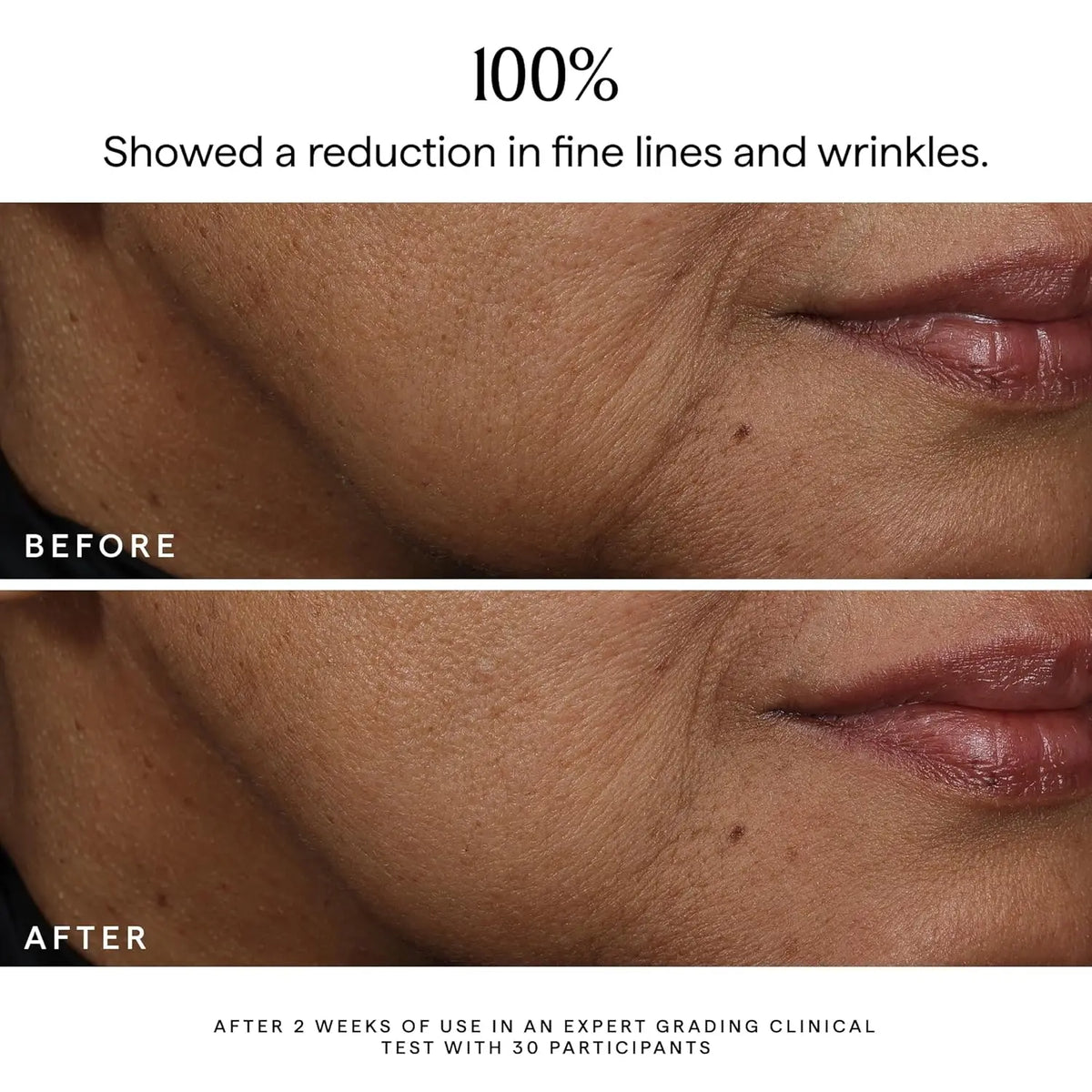 Bakuchiol Facial Rejuvenation Serum Anti Wrinkle Fade Fine Lines