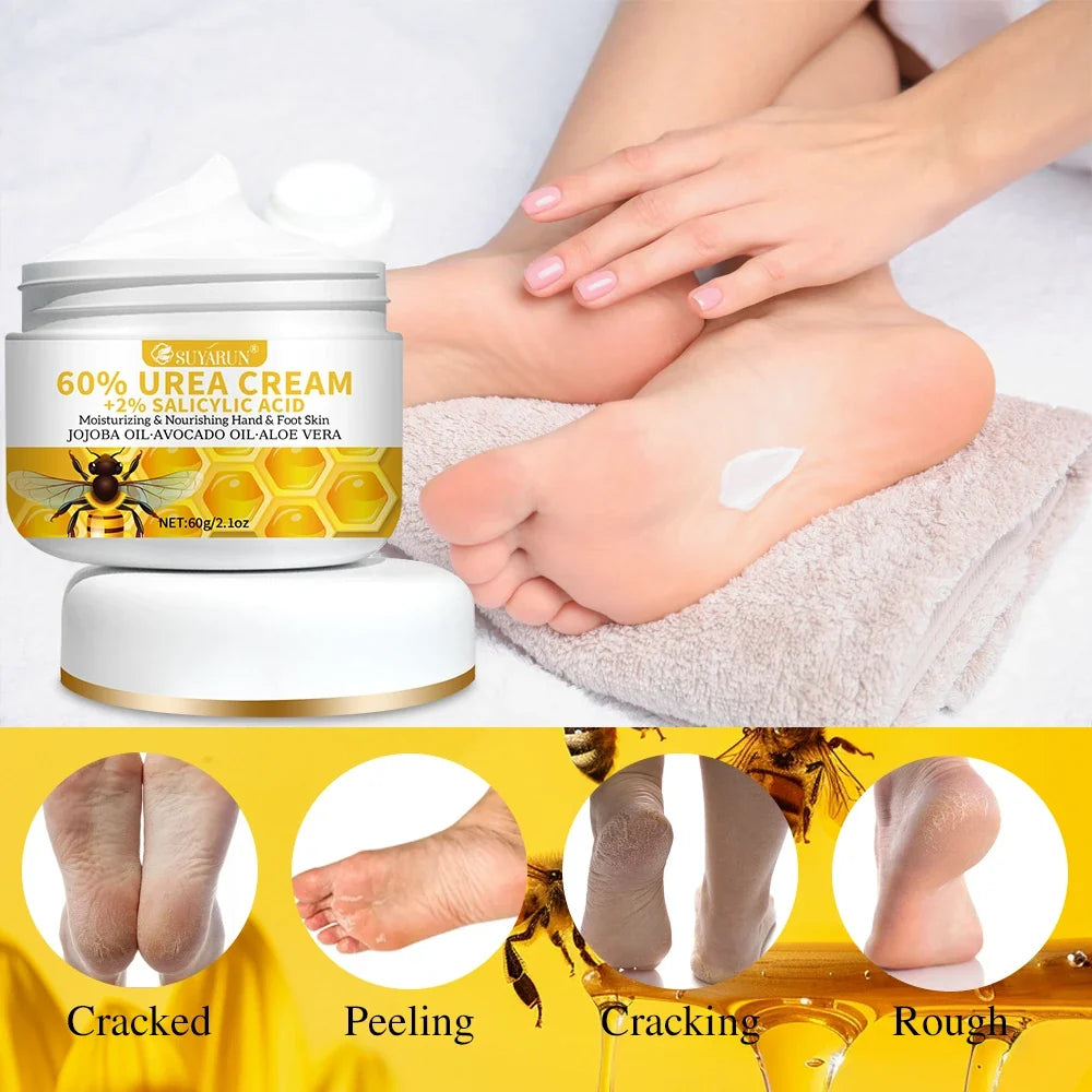 SUYARUN 60% Urea Foot Cream – Callus & Dead Skin Remover