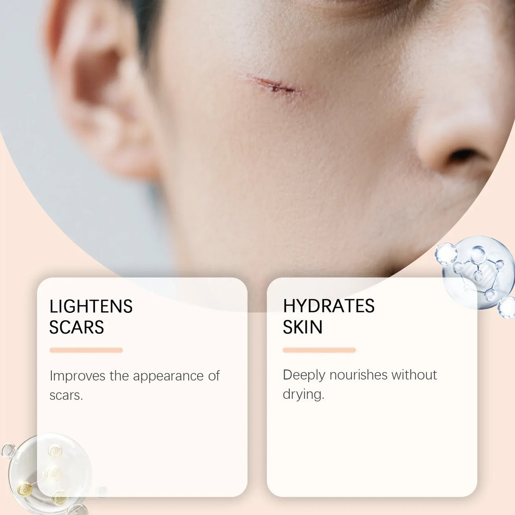 Silicone Scar Stick Acne Reducing Redness Repair Blemishes Mild