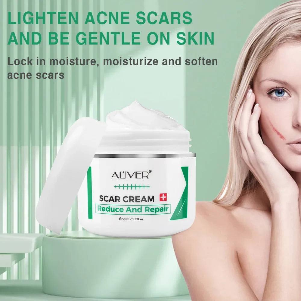 ALVER Acne Scar & Stretch Mark Remover Cream 50ml | Skin Repair