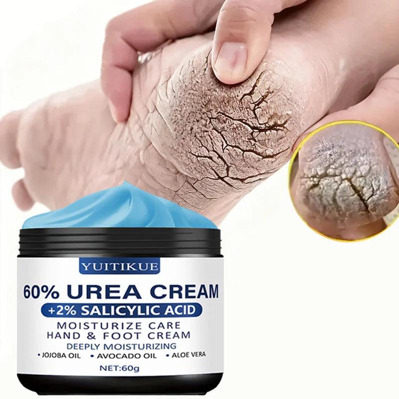 YUITIKUE 60% Urea Foot Cream 60g – Soft Heels & Smooth Skin