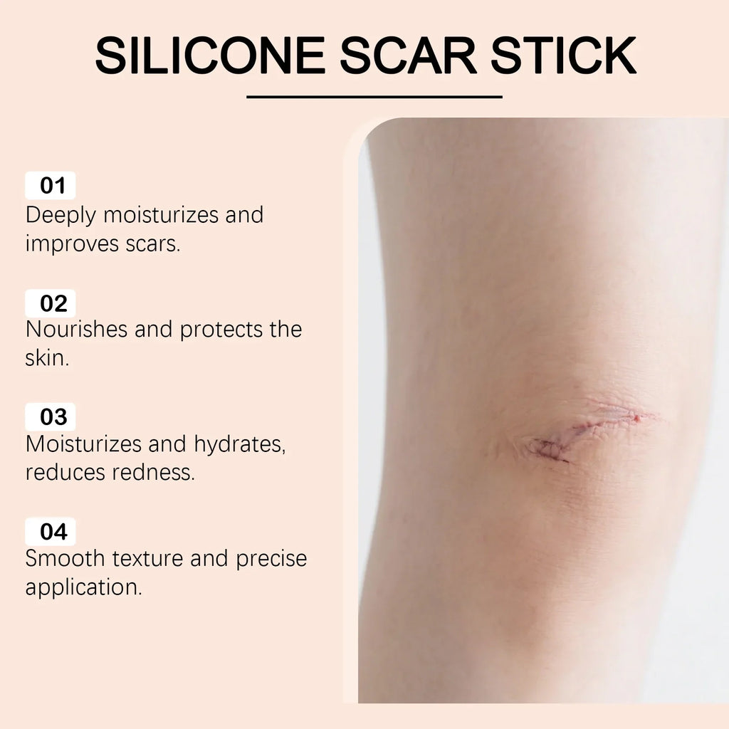 Silicone Scar Stick Acne Reducing Redness Repair Blemishes Mild