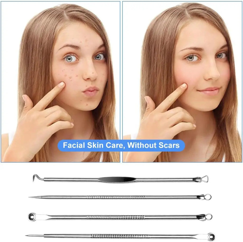 Stainless Steel Blackhead Comedone Extractor Tool Set – 4 Pcs