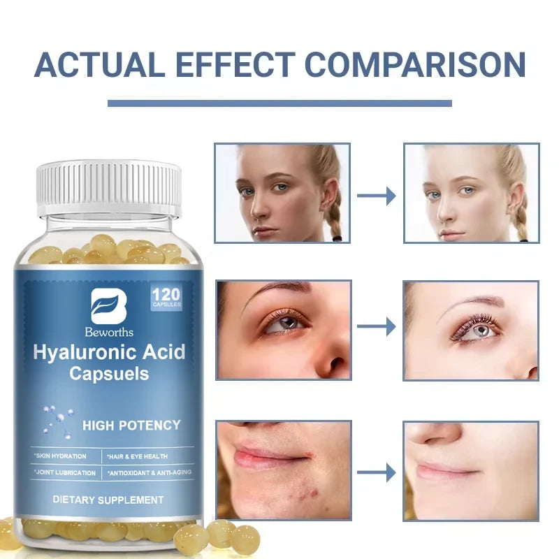 Beworths Hyaluronic Acid Capsules – Skin & Joint Health