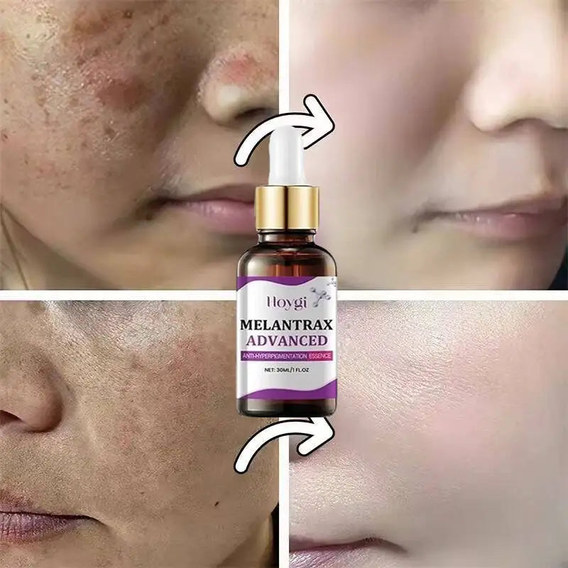 Hoygi Niacinamide Vitamin B3 Face Serum – Glow & Dark Spot Corrector