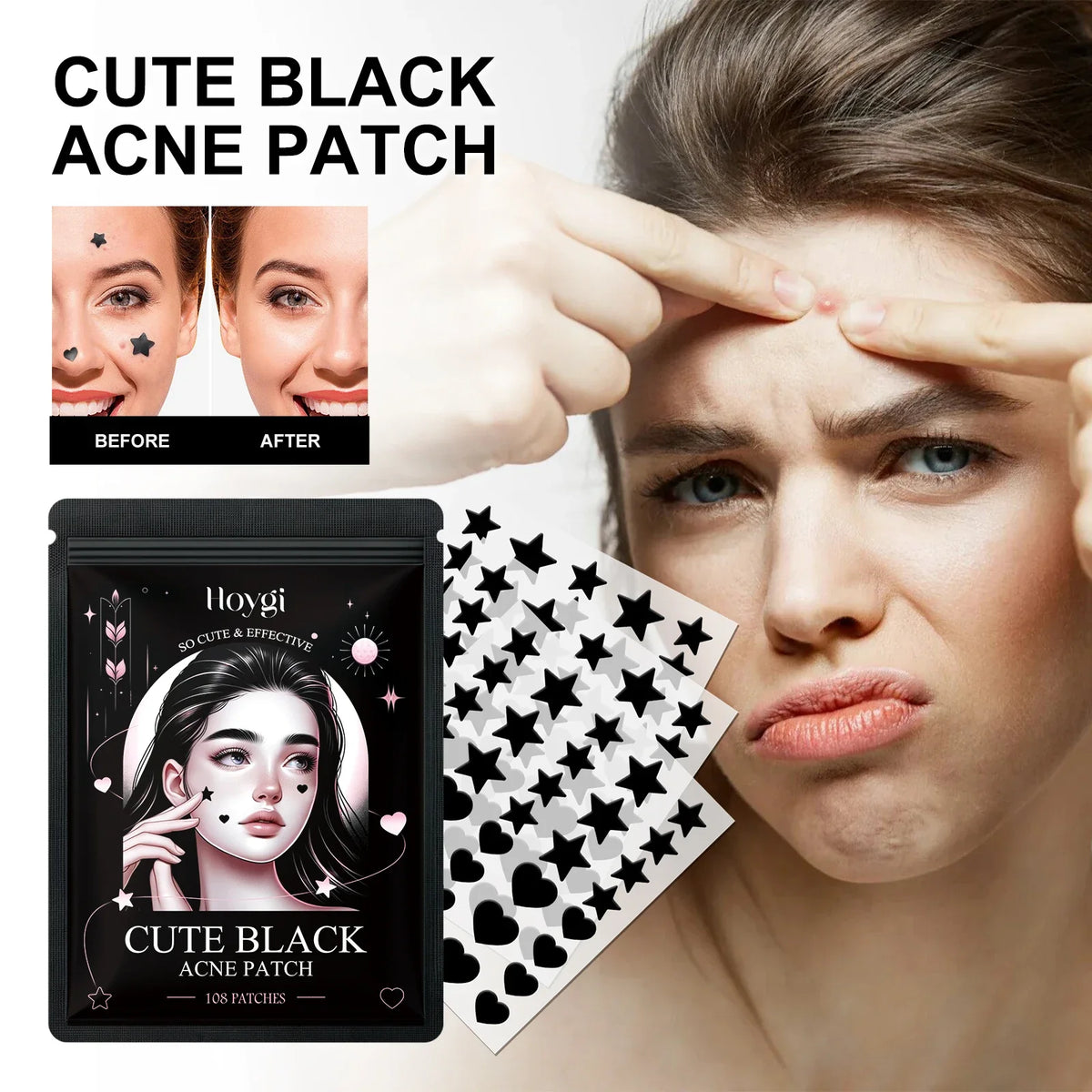 Hoygi Black Acne Patches – Spots, Blackheads & Skin Tone