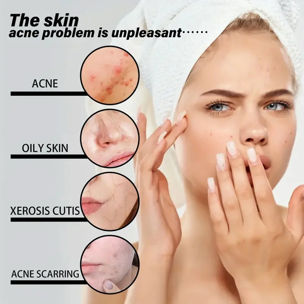 EELHOE VC Snail Serum Facial Repair Essence Redness Pores Whiten