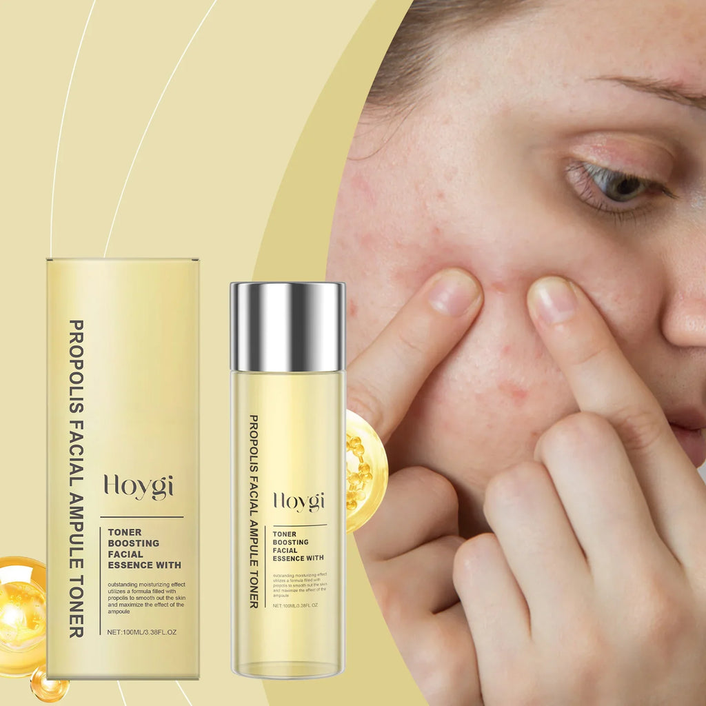 Hoygi Honey Ceramide Toner – Sensitive Skin Moisturizer