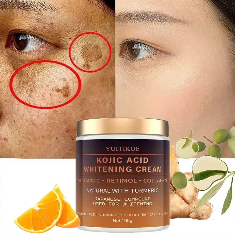 Kojic Acid Brightening Cream 100g – Vitamin C, Turmeric & Shea