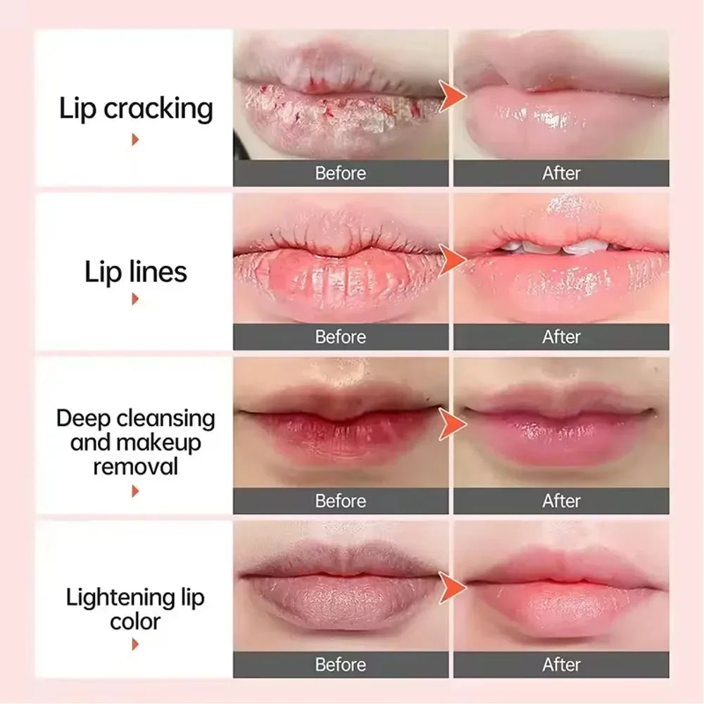 Lip Brightening Balm – Exfoliating, Moisturizing & Korean Care