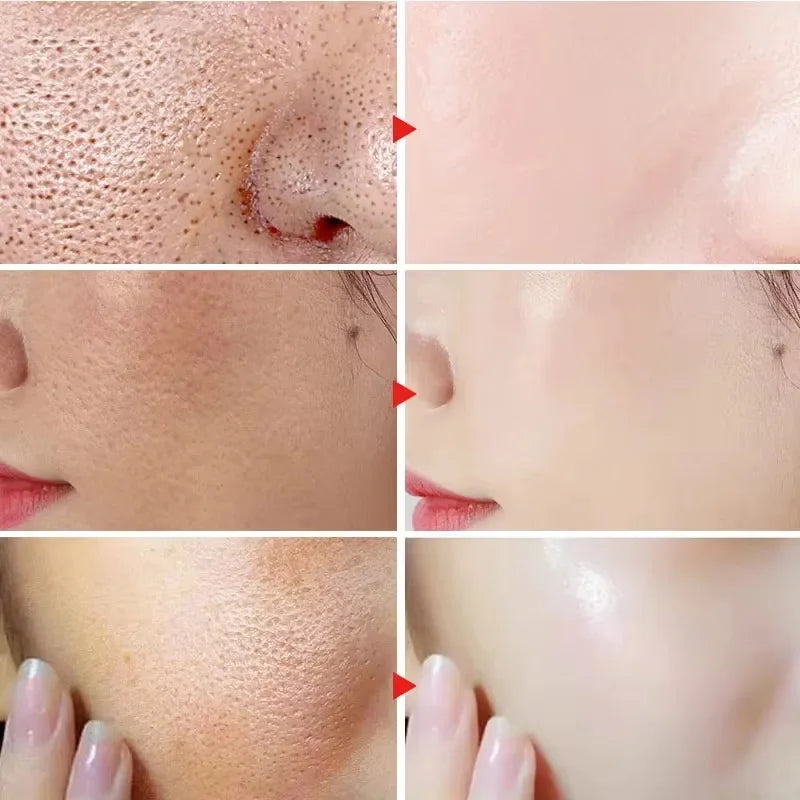SADOER Calming Face Serum – Sensitive Skin & Pore Minimizer
