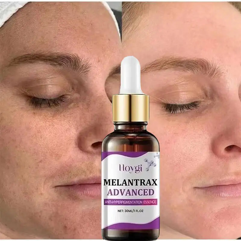 Hoygi Niacinamide Vitamin B3 Face Serum – Glow & Dark Spot Corrector