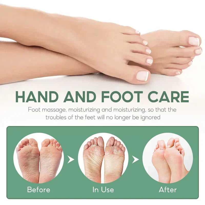 LAIKOU Herbal Foot Cream Spray – Soften & Moisturize Heels