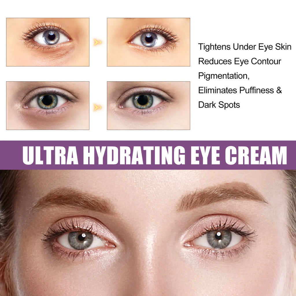 Eelhoe Eye Cream – Dark Circles, Bags & Fine Lines 15g