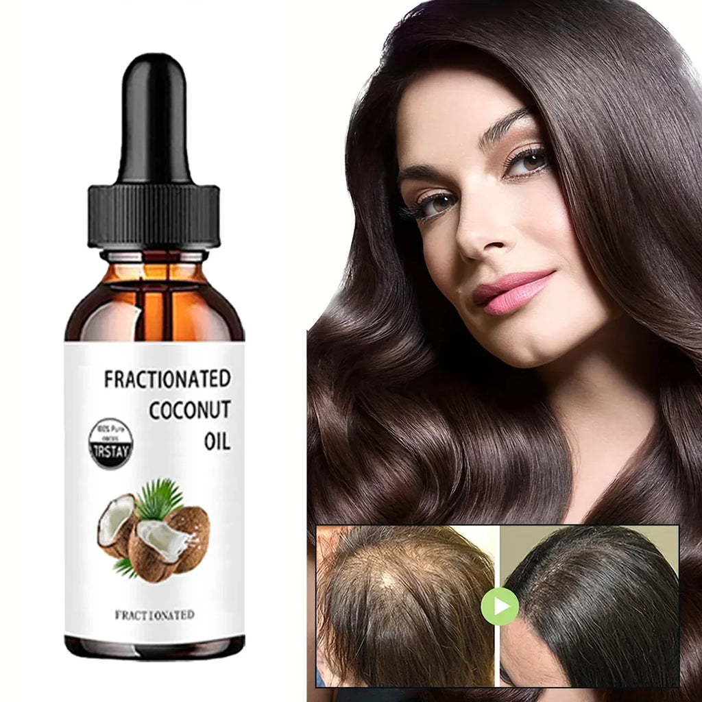 TRSTAY 100% Pure Fractionated Coconut Oil – Moisturizing Face Oil
