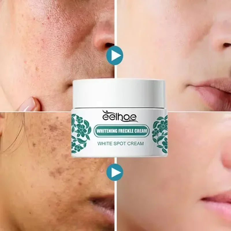 Eelhoe Vitamin C Face Cream – Dark Spot & Brightening Corrector