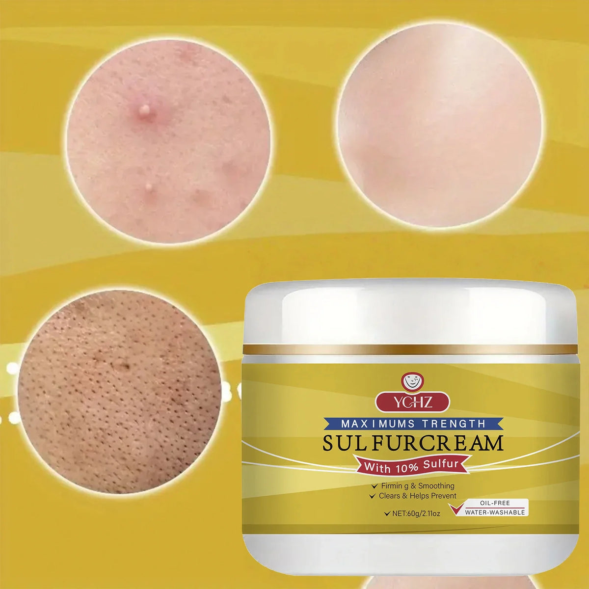 YCHZ Sulfur Face Cream – Brightening & Moisturizing | 60g