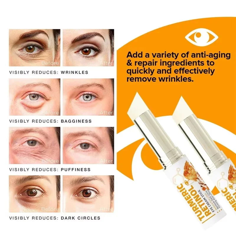 SADOER Retinol Eye Cream – Brighten, Firm & Hydrate