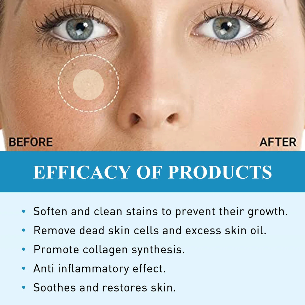 South Moon 144pc Hydrocolloid Blemish Patches | Salicylic & Cica