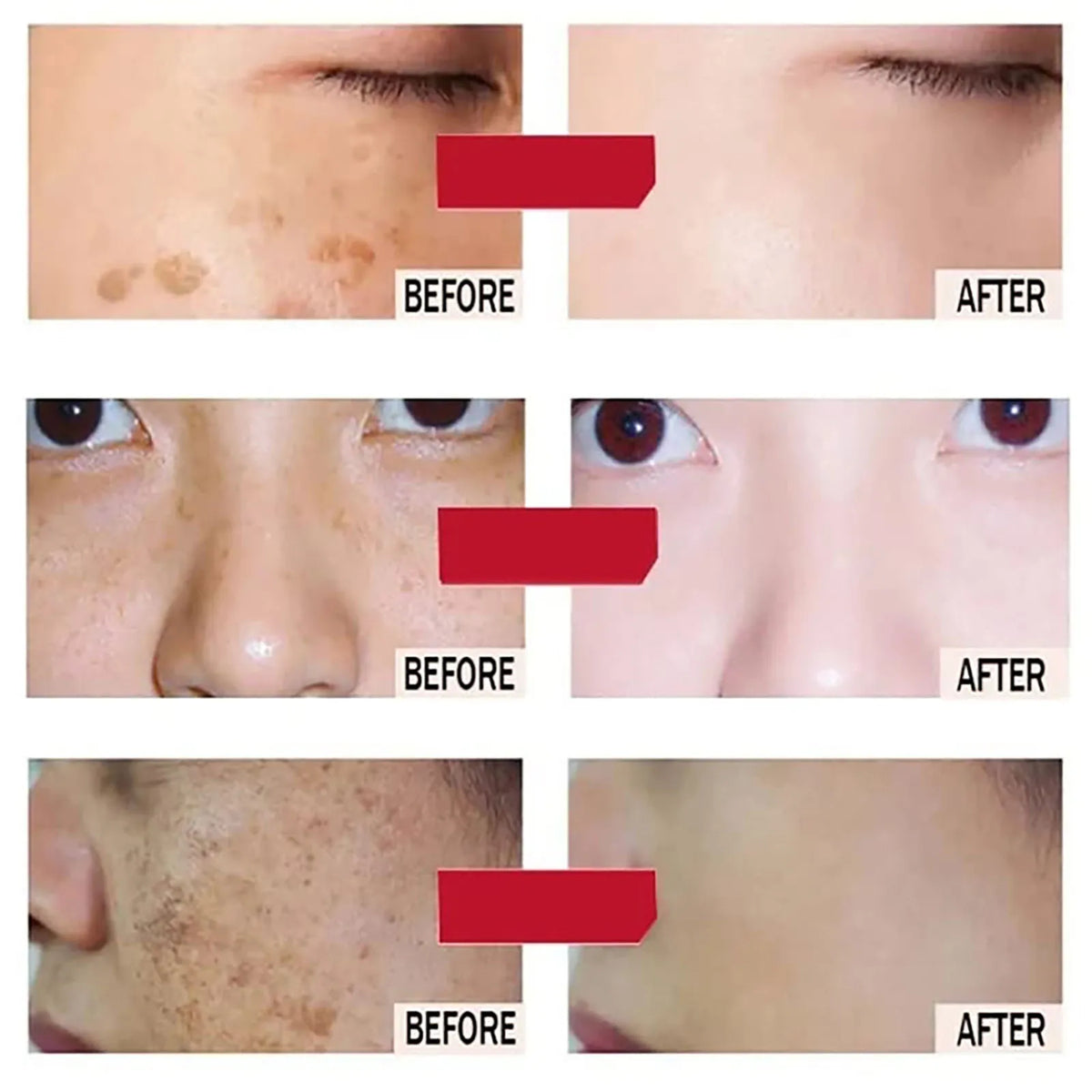 AILKE Amino Acid Facial Cleanser – Oil Control & Brightening