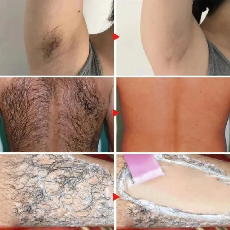 SADOER Hair Removal Cream & Growth Inhibitor – Body & Face