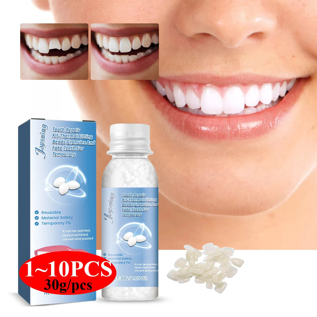 Jaysuing 30g Moldable Temporary Tooth Repair Gel Kit