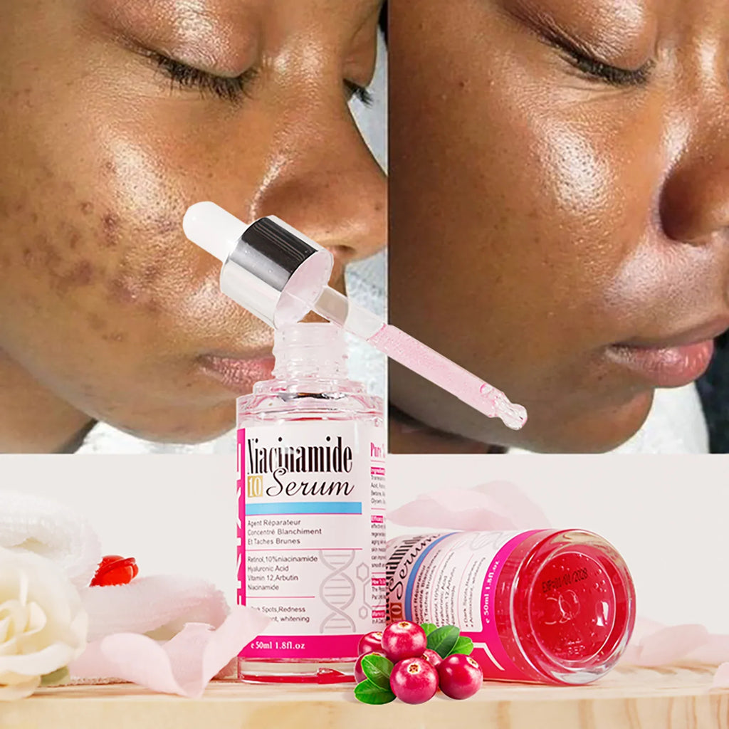 AILKE Niacinamide Whitening Serum | Hyaluronic Acid Face & Body