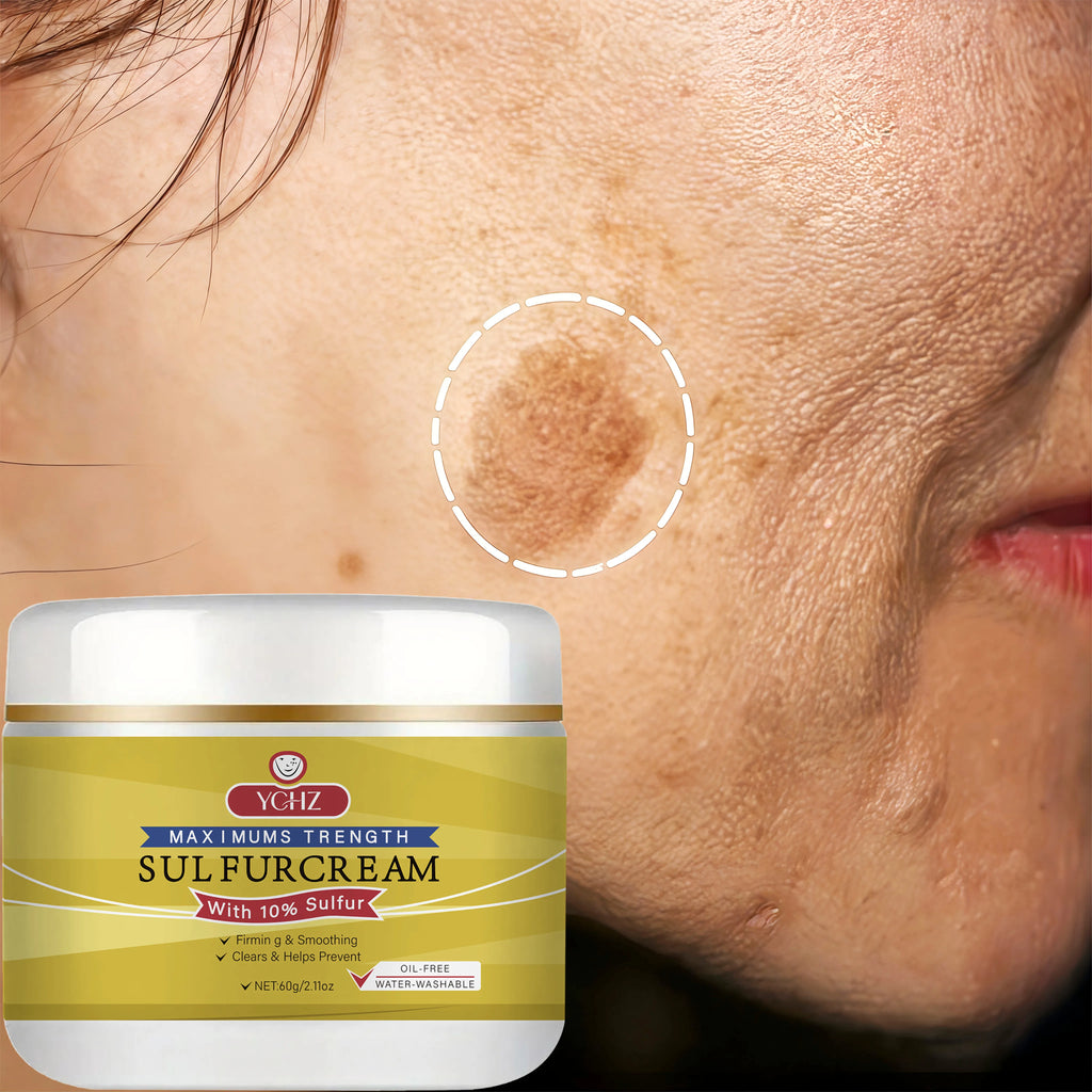 YCHZ Sulfur Face Cream – Brightening & Moisturizing | 60g