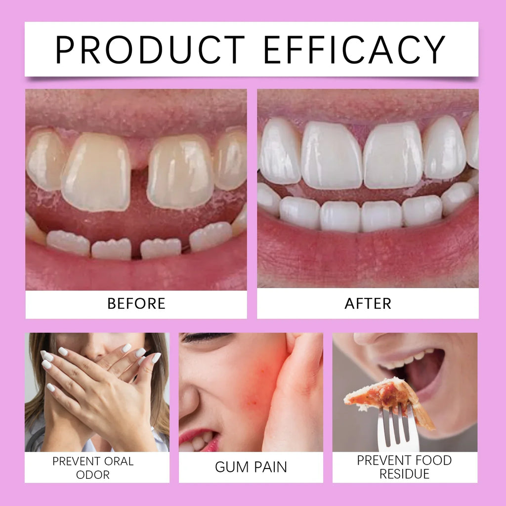 Oralhoe Strong Denture Adhesive Cream – 20g False Teeth Glue