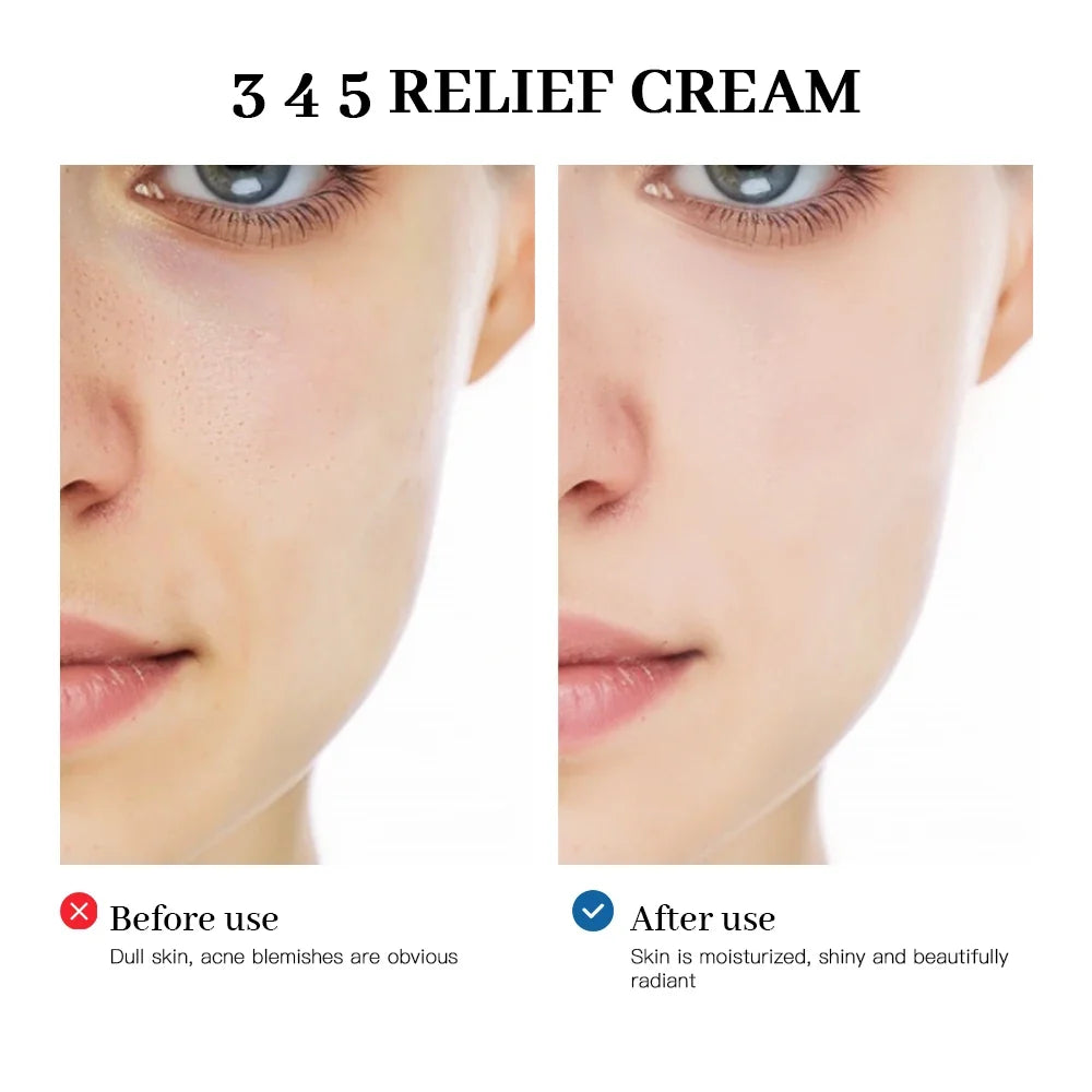 345 Relief Cream – Brightening, Moisturizing & Blemish Care