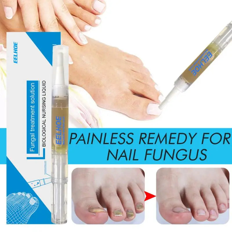 Nail Brightening & Cleansing Solution – Tea Tree & Jojoba 3ml