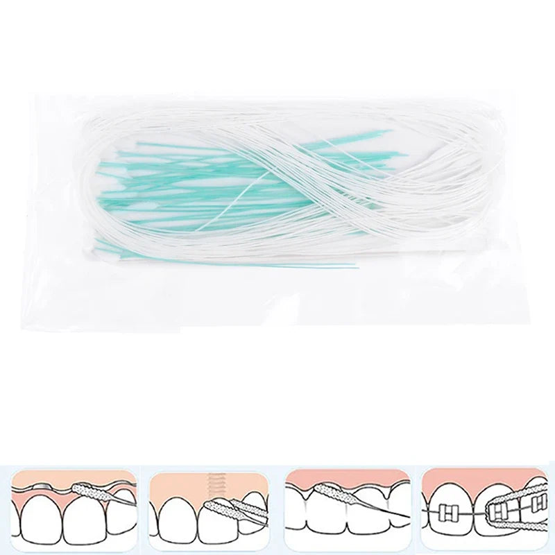 50-Pack Dental Floss Threaders for Braces, Bridges & Implants