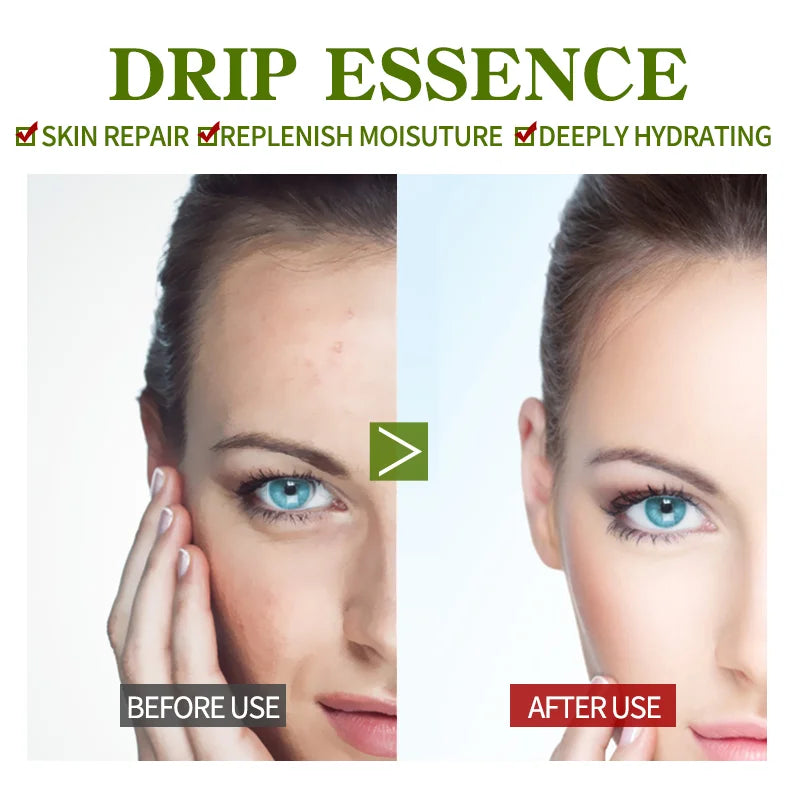 Repair Spray Aloe Vera Toner Sensitive Skin Improve Rough Essence