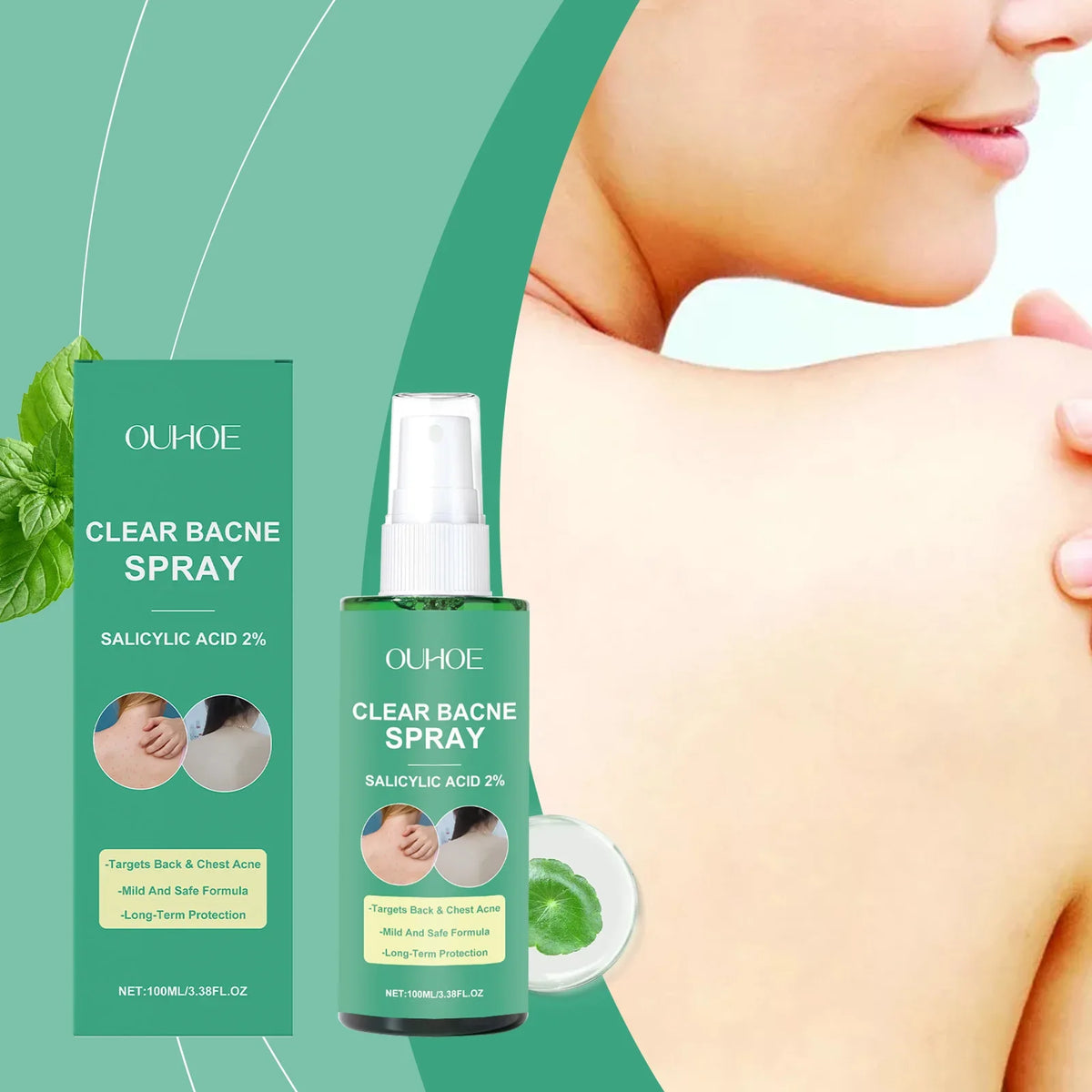 Back Acne Treatment Spray – Oil Control & Soothing Body Spray