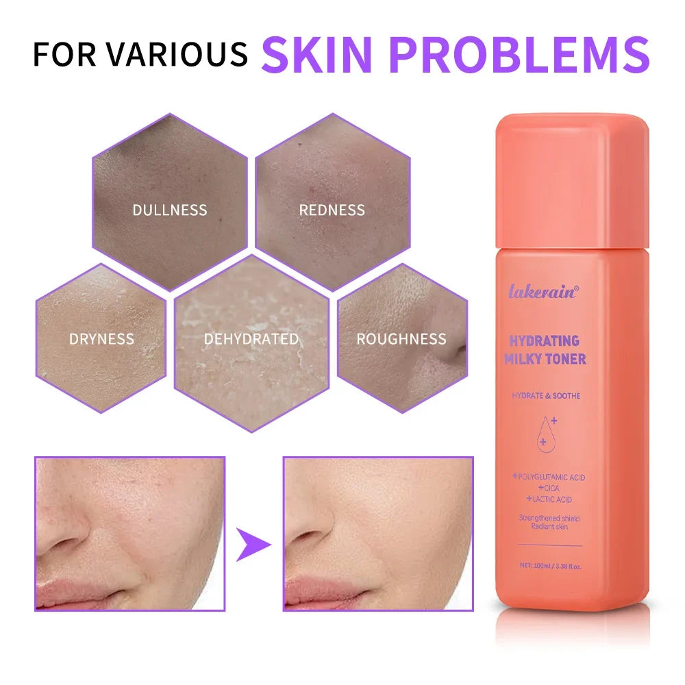Hydrating Milky Toner – Deep Moisture & Barrier Repair | 100ml