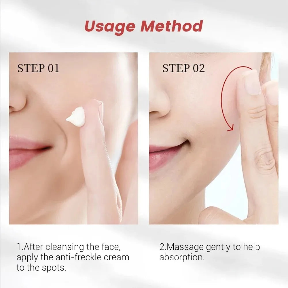 Niacinamide Whitening Freckle Cream | Dark Spot & Melasma