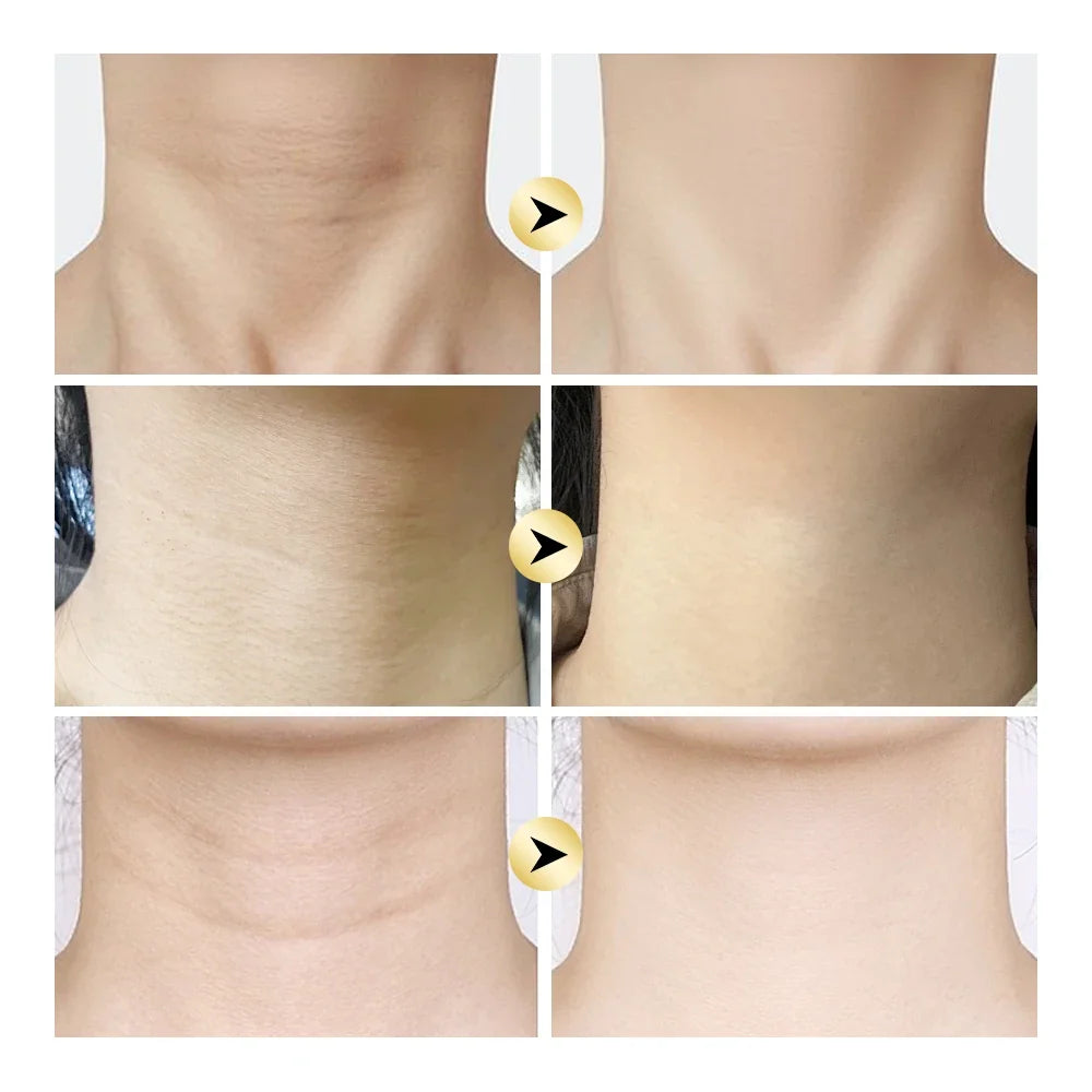 Ah-8 Firming Neck Cream Moisturizing Lotion Crepey Skin Comfortable