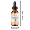 Frankincense Gum Essential Oil – Face, Body, Hair & Diffusion