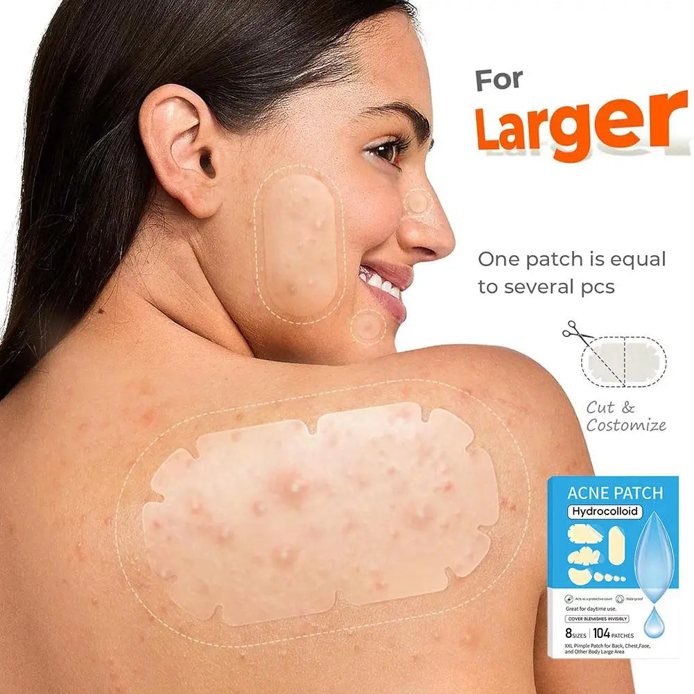Hydrocolloid Acne Patches – Invisible Spot Treatment