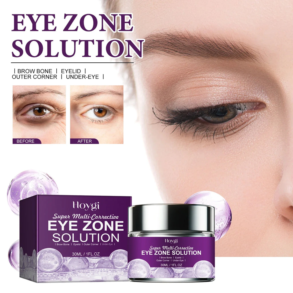 Hoygi Eye Cream – Dark Circles, Bags & Wrinkles 30ml