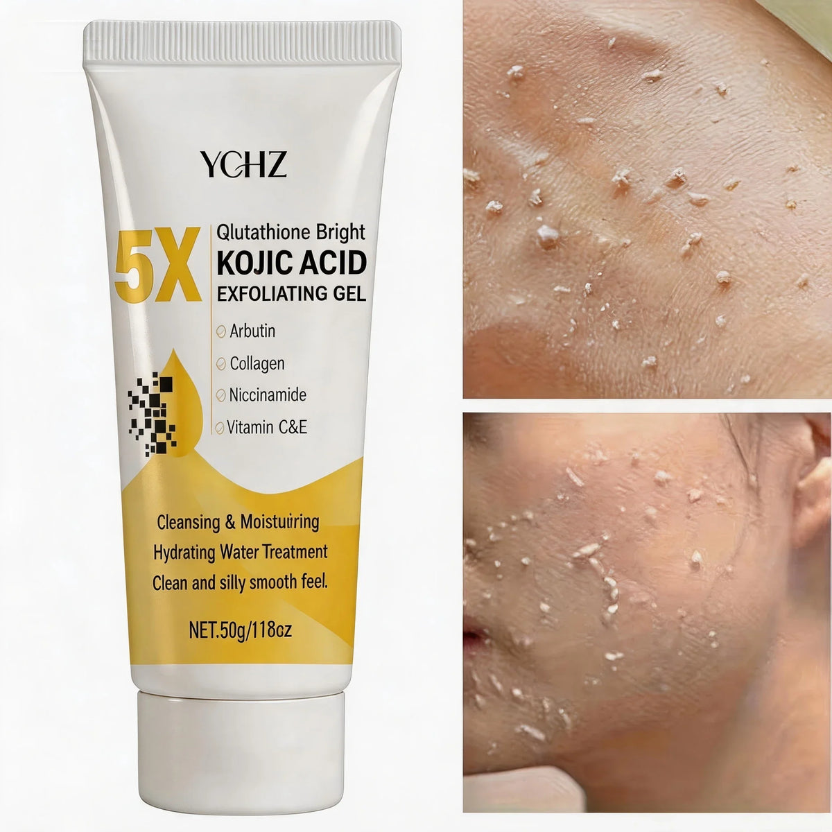 Kojic Acid Exfoliating Gel – Brighten, Even Tone & Moisturize