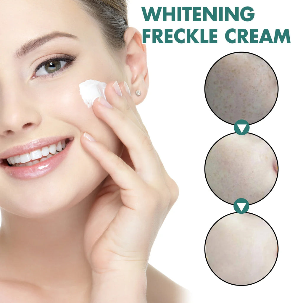 Brightening Dark Spot Corrector Cream – Hydrates & Evens Skin
