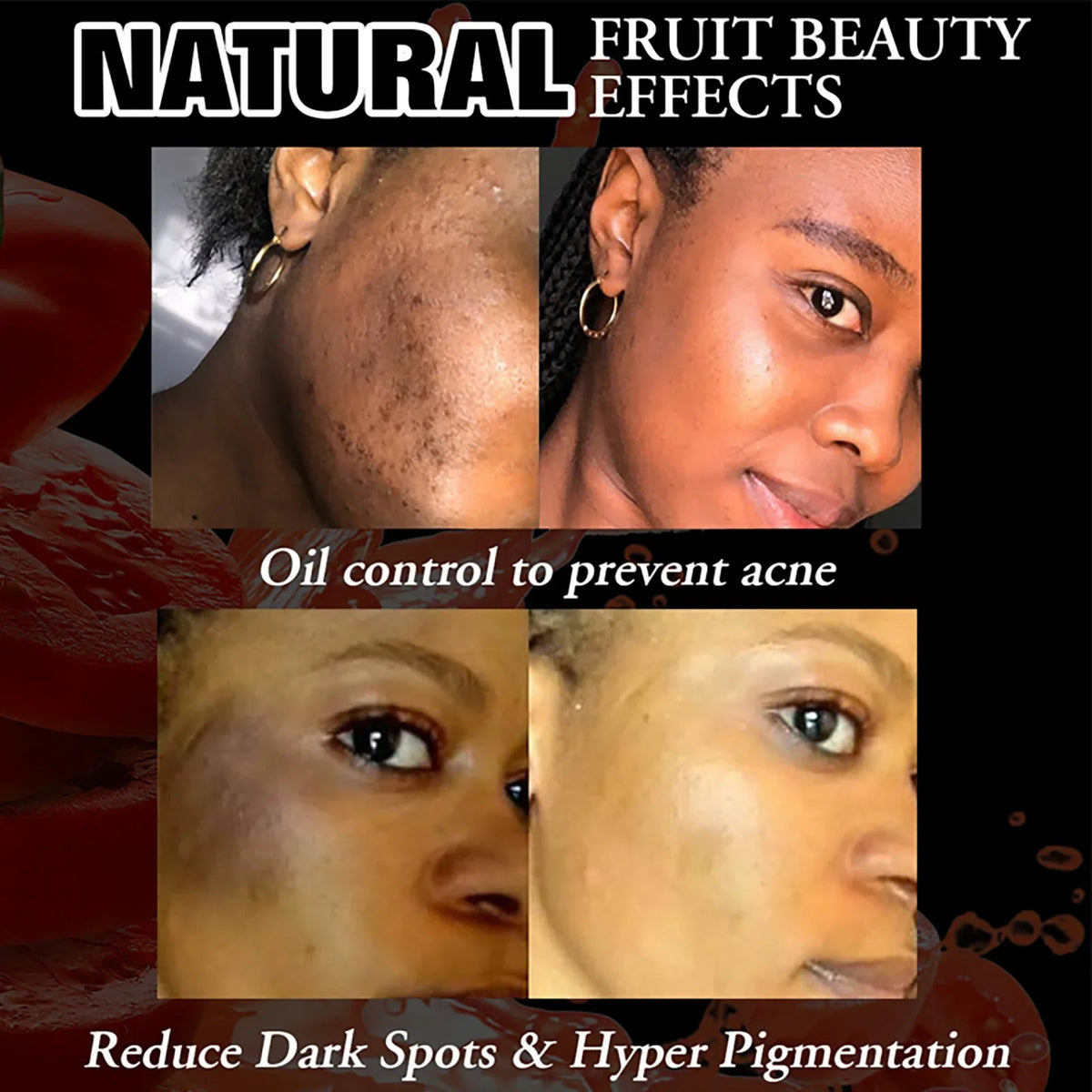 AILKE Tomato Brightening Soap Bar | Even Skin Tone 200g