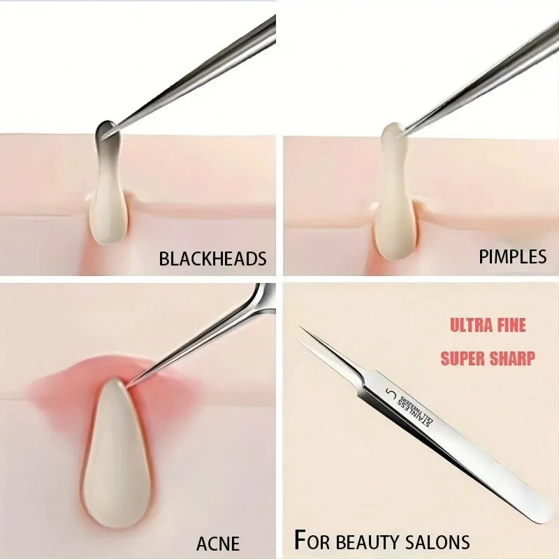 No. 5 Extra Fine Blackhead Removal Tweezers | Skincare Tool