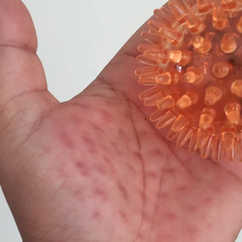 Spiky Ball Hollow Soft Transparent Strength Recovery Exercise Stress