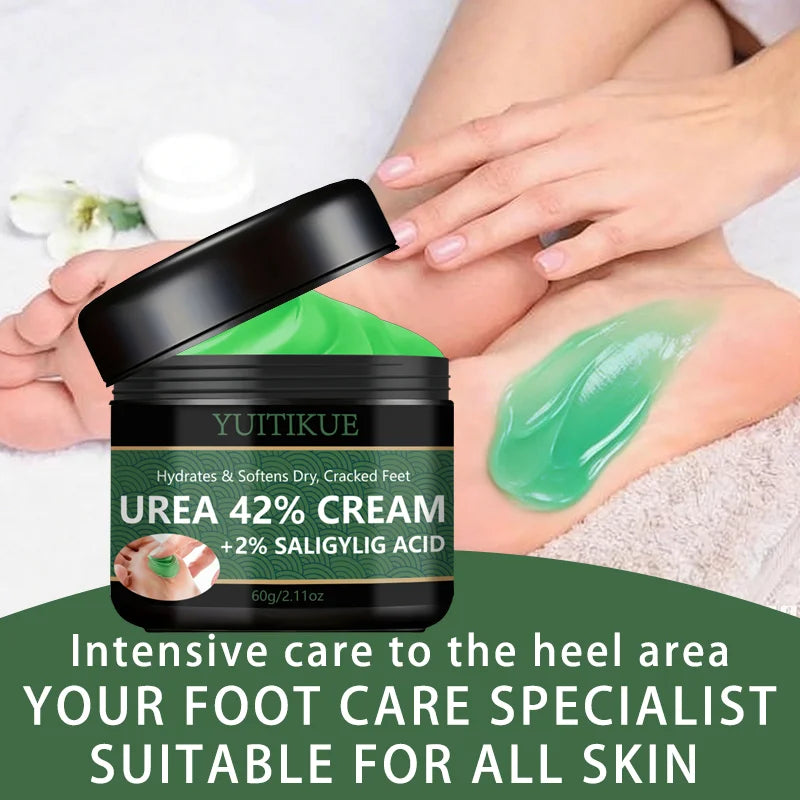 YUITIKUE 42% Urea Foot Cream – Softens Calluses & Hydrates