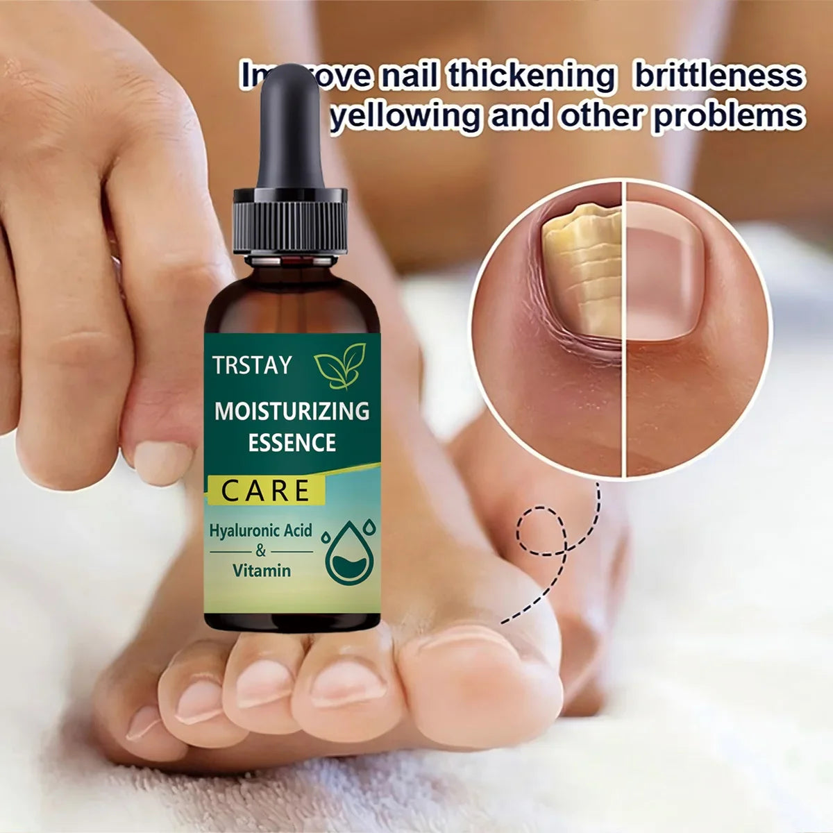 7DAYS Nail Repair Essence Gel – Toe & Foot Care Serum